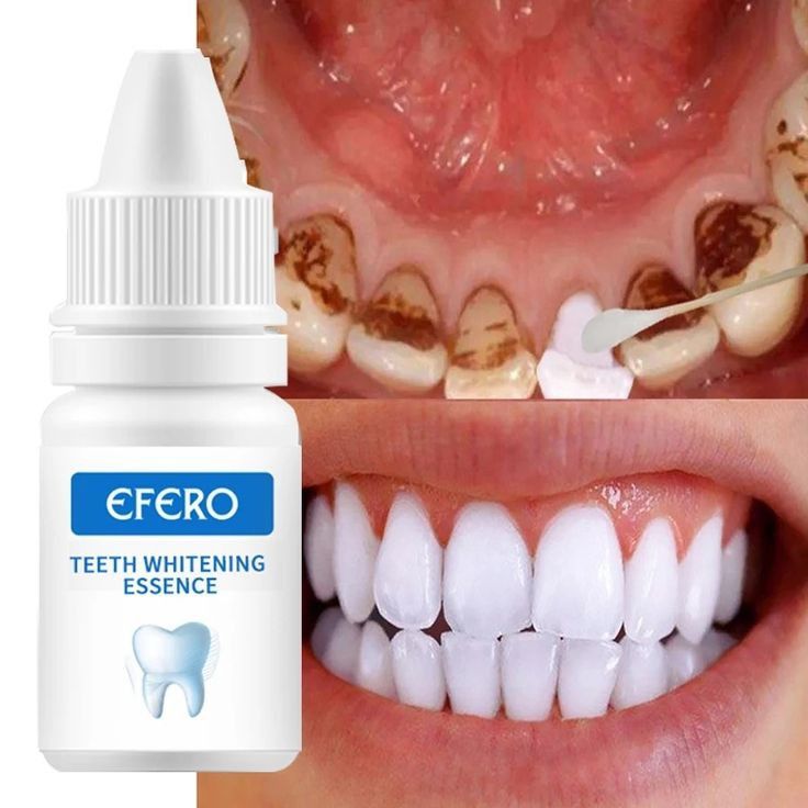 EFERO™ – Essence Blanchissante Ultra-Puissante | Élimine Tartre & Taches en Quelques Jours