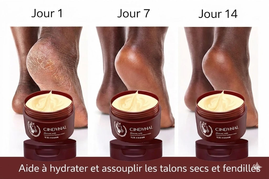 Dites Adieu Aux Pieds Et Mains Fendillés En Quelques Jours