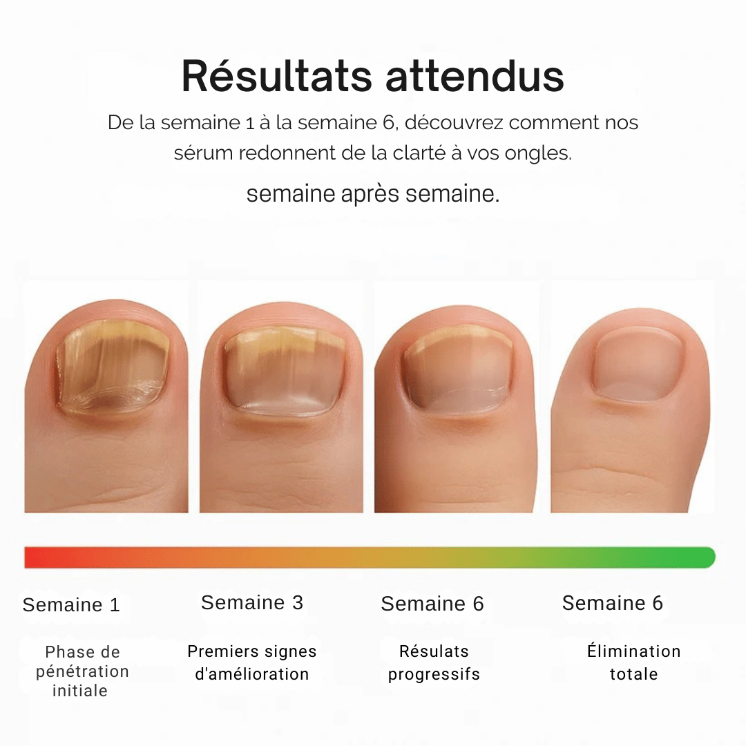 Traitement anti-mycoses des ongles (7 jours).