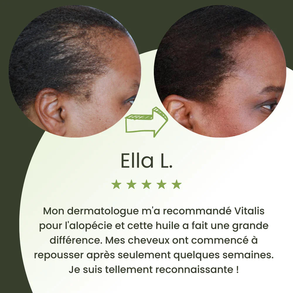 Huile naturelle pour la croissance des cheveux
