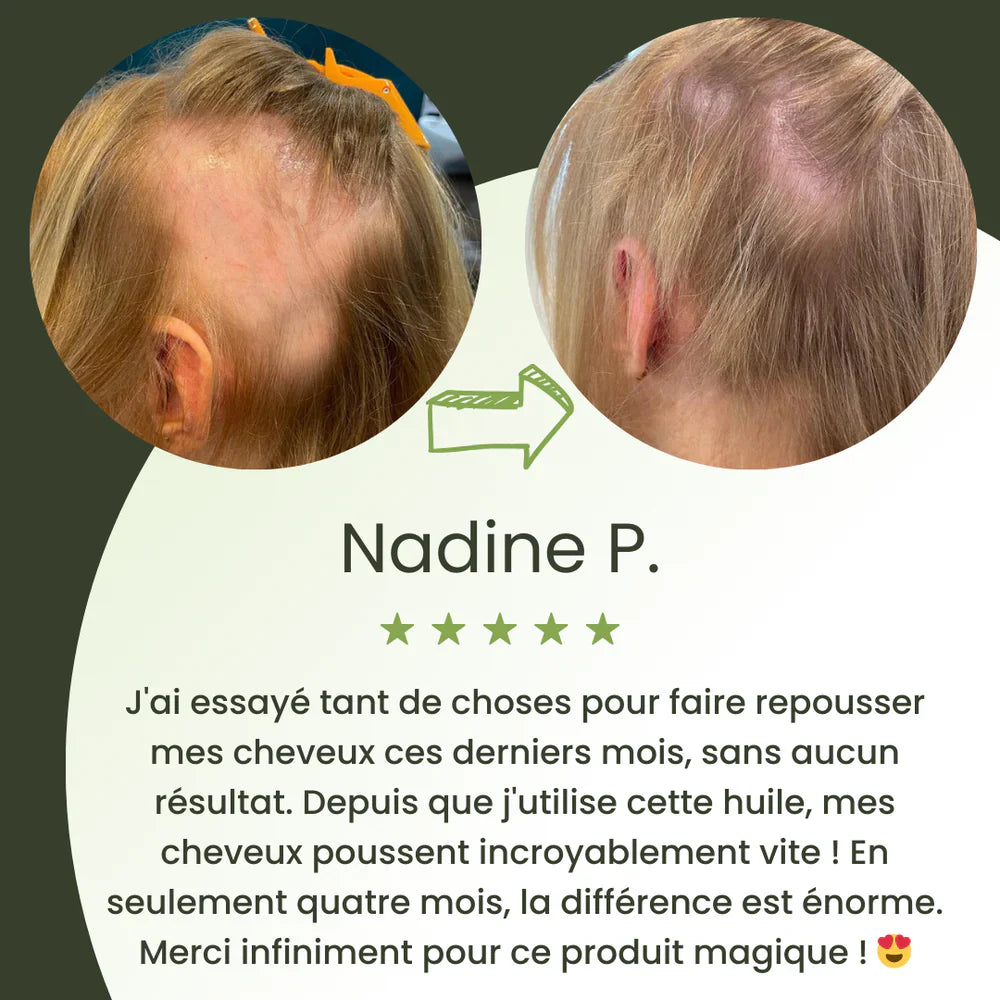 Huile naturelle pour la croissance des cheveux