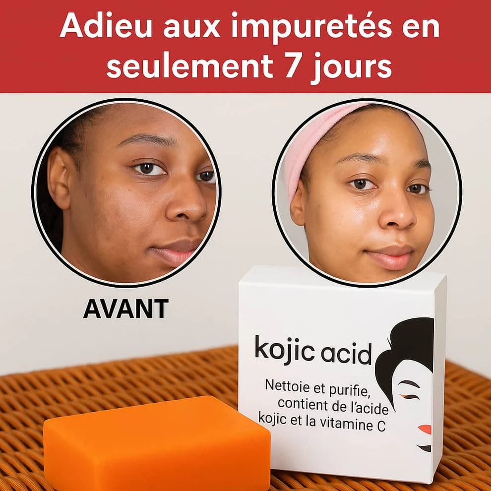 Savon Kojic San : Éclat Naturel, Peau Nette, Fraîche & Éclatante
