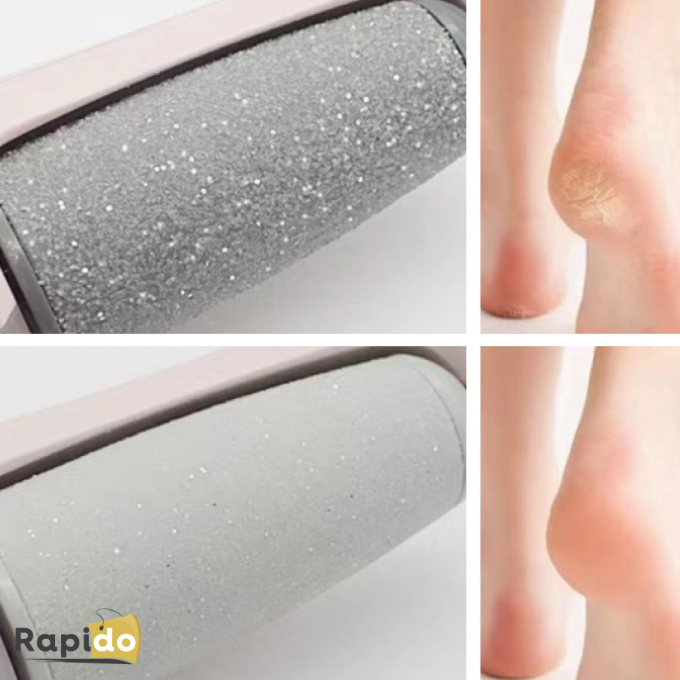 La Beauté des Pieds à Domicile – Ponceuse Anti-Callosités Professionnelle™