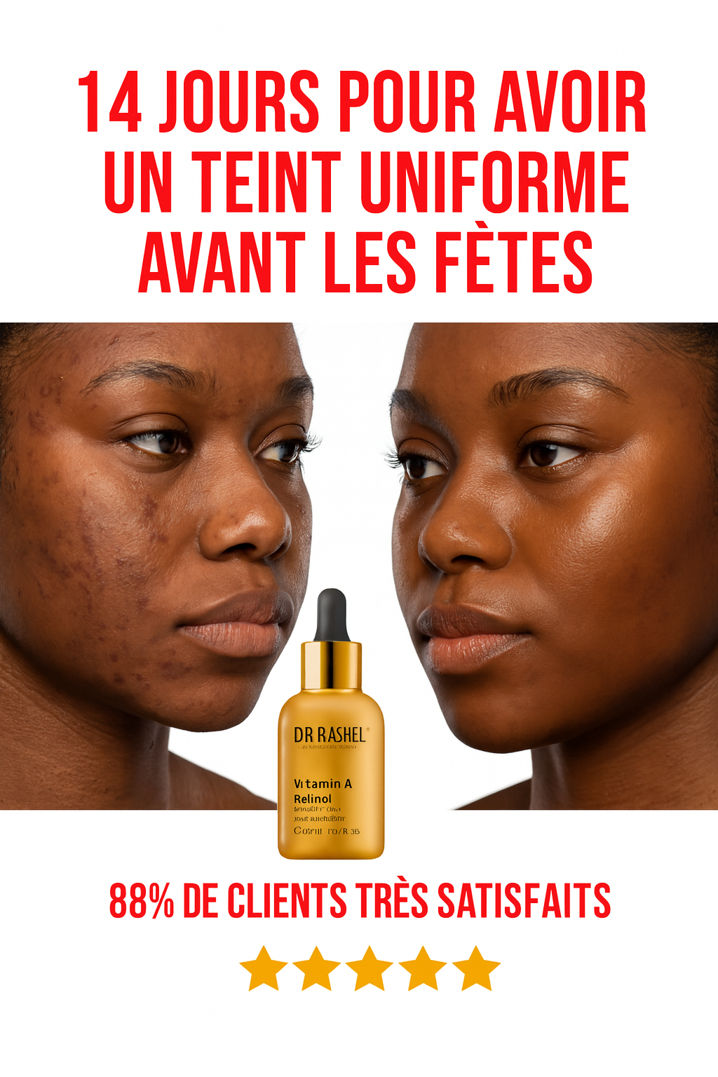 Sérum anti-âge anti-ride
