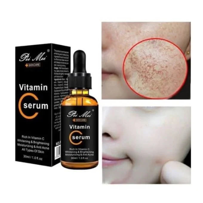 Sérum Vitamine C — Éclat, Anti -Taches & Hydratation Intense